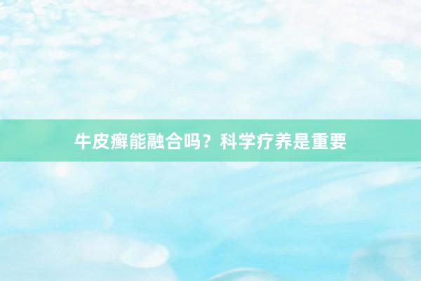 牛皮癣能融合吗？科学疗养是重要